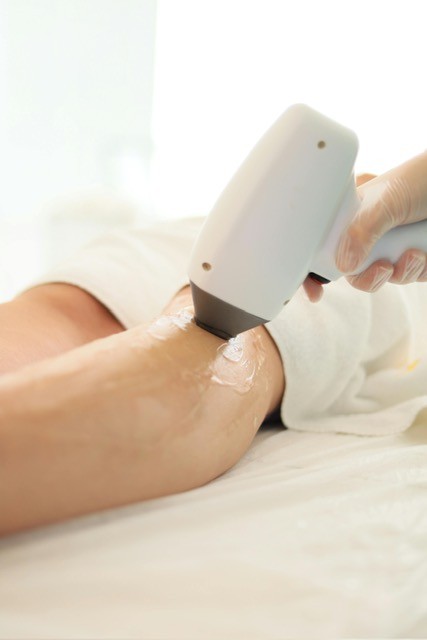 Diode hair removal